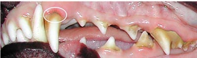 Stage 2 moderate gingivitis with inflammation & some swelling, calculus levels mild to heavy.